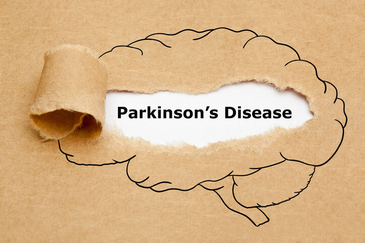 Brain with paper peeled back to show the quote Parkinson's disease