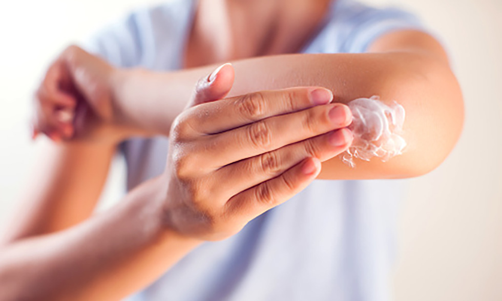 Thick unscented lotions and petroleum jelly can help relieve some of the uncomfortable symptoms of an eczema flare-up.